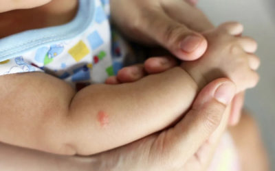 The Best Ways To Protect Babies From Getting Mosquito Bites In Your Yard…